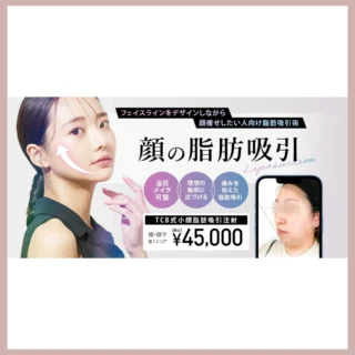 TCB東京中央美容外科