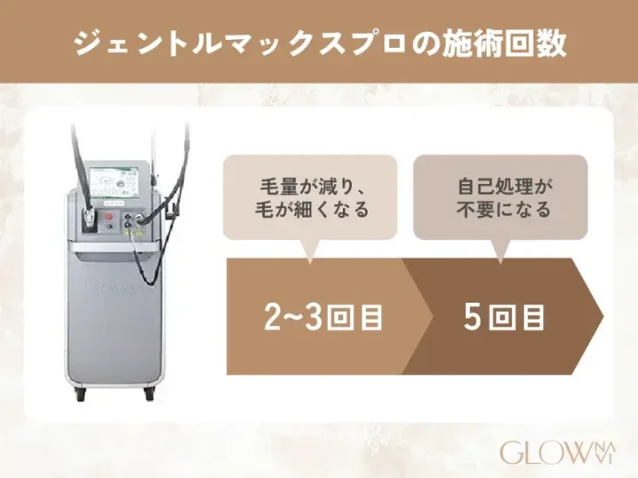 H2_-ジェントルマックスプロの施術回数