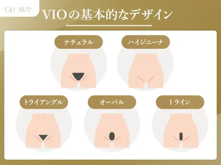 VIOの基本的なデザイン