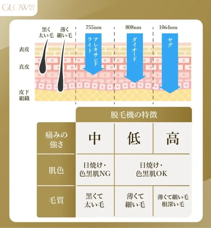 脱毛機の種類