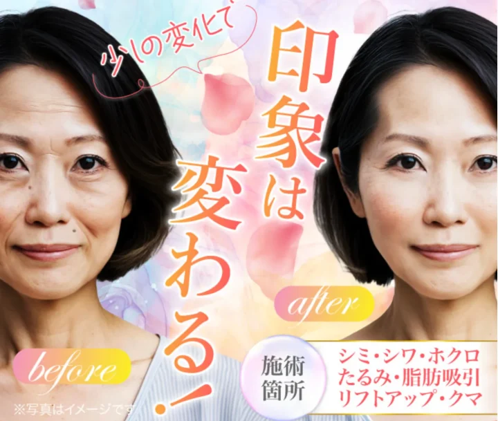 TCB東京中央美容外科