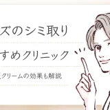 メンズ　シミ取り