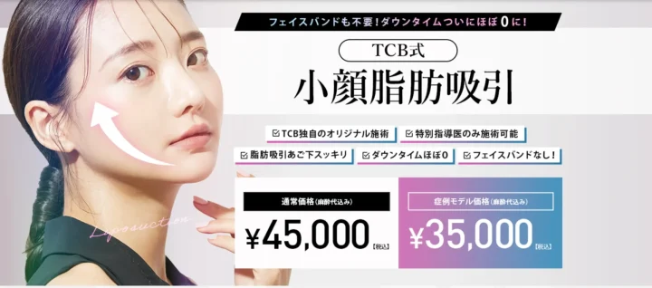 TCB東京中央美容外科