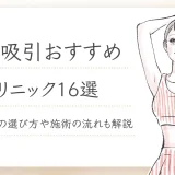 脂肪吸引おすすめ