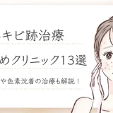ニキビ跡治療　おすすめ-1