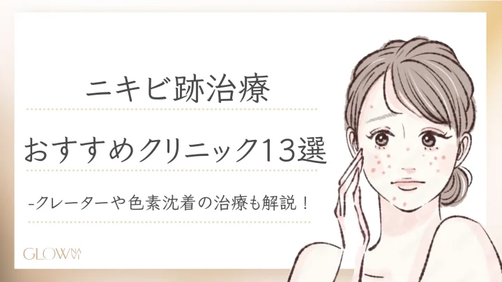 ニキビ跡治療　おすすめ-1
