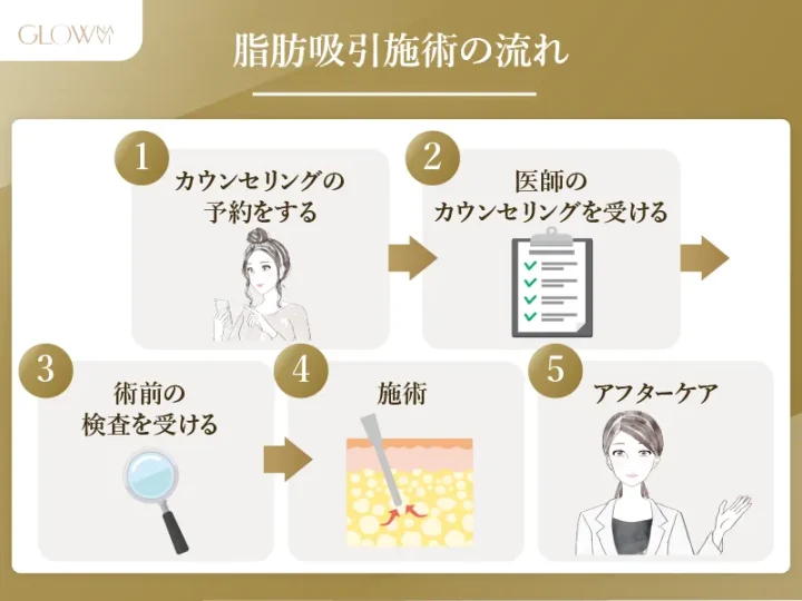 脂肪吸引施術の流れ