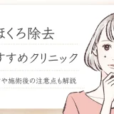 ほくろ除去　おすすめ
