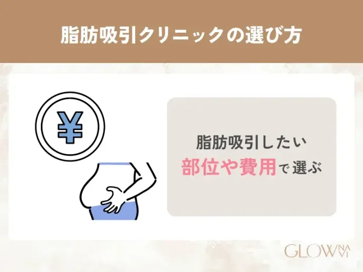 脂肪吸引したい部位や費用で選ぶ