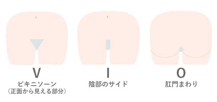 VIOの施術範囲