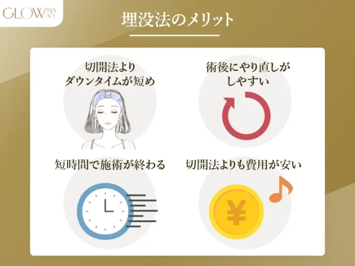 埋没法のメリット 解説画像