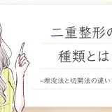 二重整形　種類