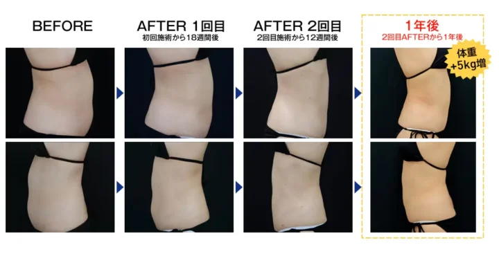 湘南美容クリニック症例写真