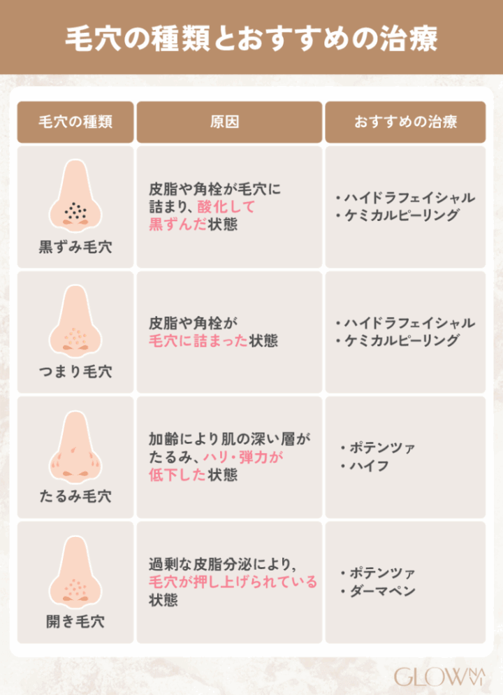 毛穴の悩みにあったおすすめの治療法一覧表