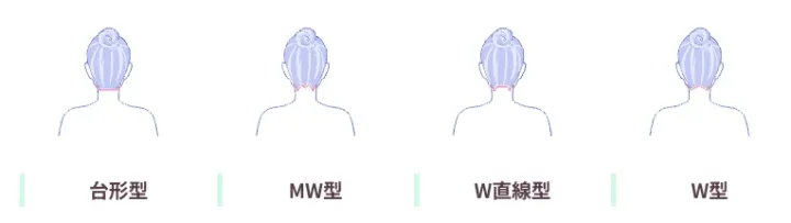 医療脱毛　うなじデザイン