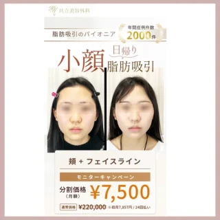 共立-脂肪吸引