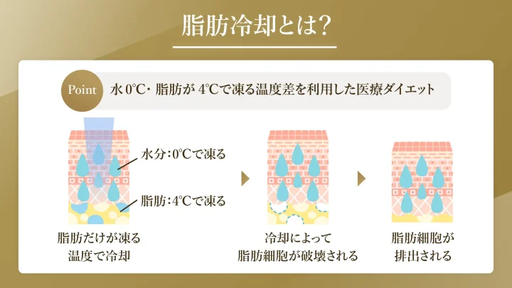 脂肪冷却　とは