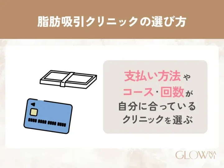 支払いの仕方・回数・コースが自分に合っているか