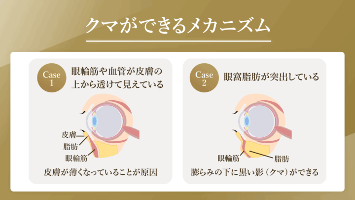 クマができるメカニズム