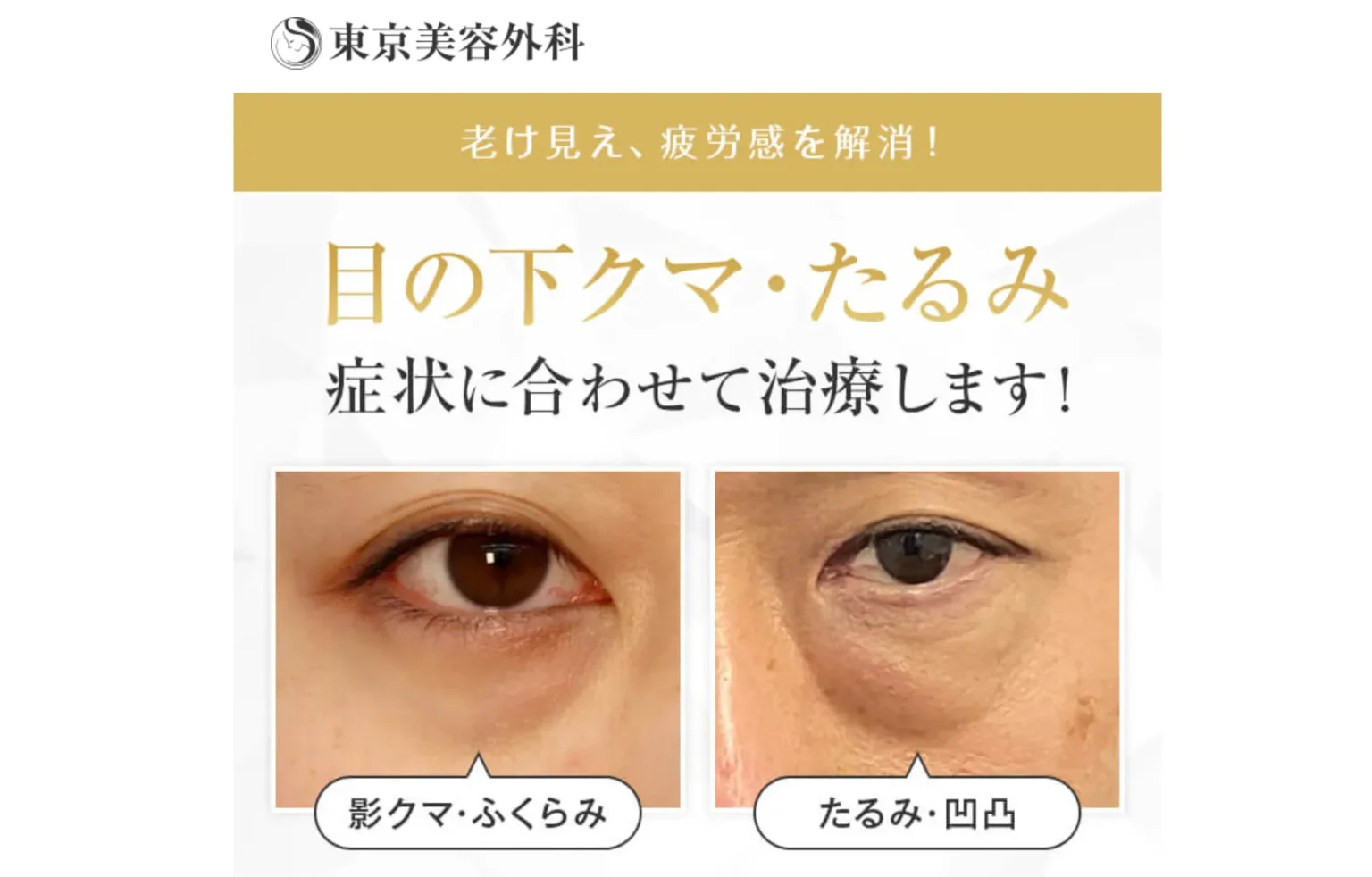 東京美容外科
