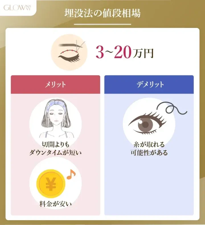 埋没法の相場