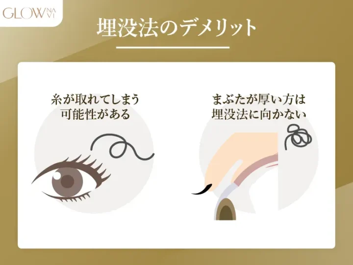 埋没法のデメリット
