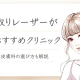 シミ取りレーザー　安い