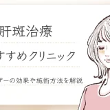 肝斑治療おすすめ