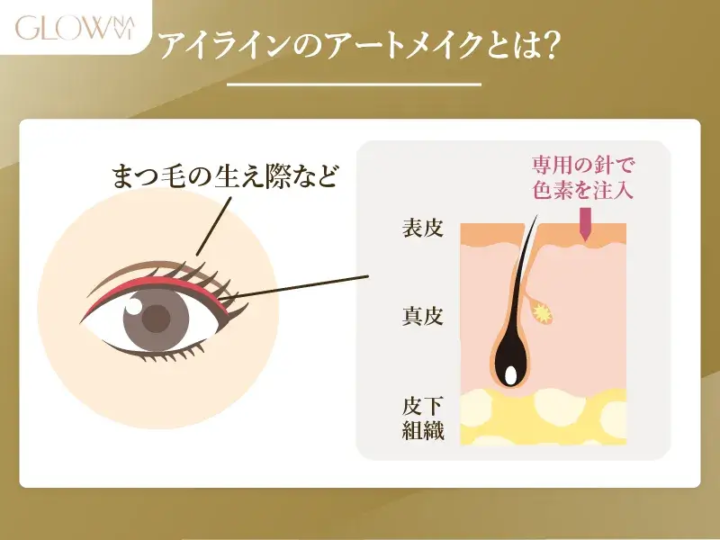 アイラインのアートメイクとは まつ毛の生え際などの表皮に専用の針で色素を注入