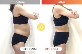 医療ダイエット