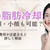 顔の脂肪冷却｜アイキャッチ