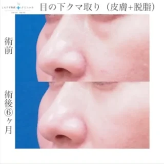 しらさぎ形成クリニック クマ取り