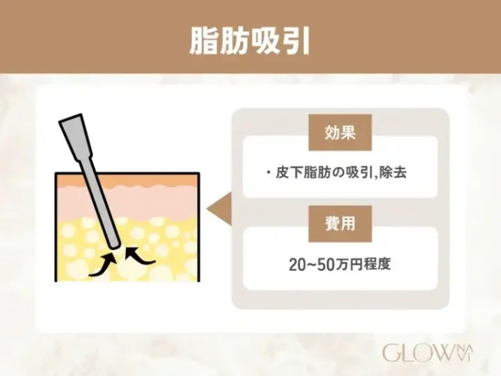 脂肪吸引