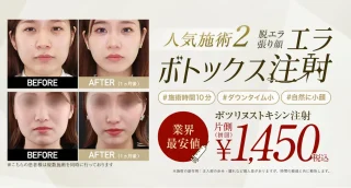 エラボトックス