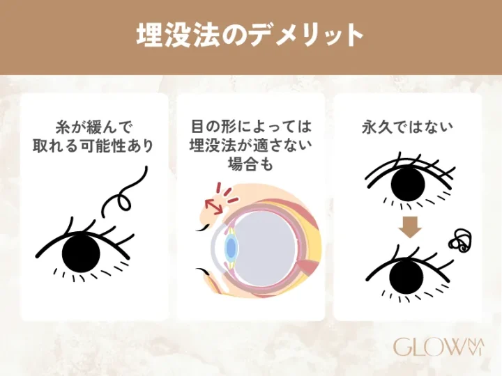 埋没法のデメリット