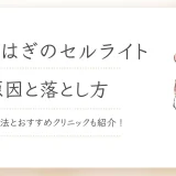 ふくらはぎセルライト落とし方