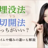 埋没法VS切開法｜アイキャッチ