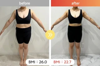 医療ダイエット