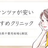 ポテンツァ　安い