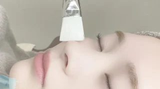 ピーリング