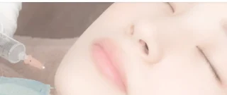 ボトックス
