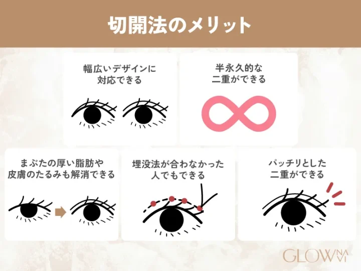 切開法のメリット