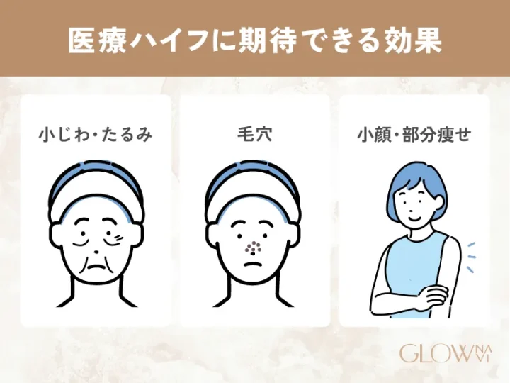 医療ハイフ(HIFU)に期待できる効果
