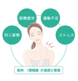 ガーデンクリニック　肩ボトックス