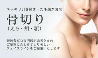 東京美容外科　骨切り