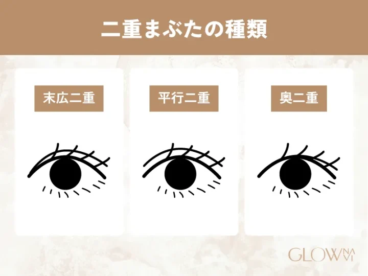 二重まぶたにはどんな種類があるの？