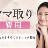 クマ取りの費用はいくら？値段相場とおすすめのクリニック紹介のアイキャッチ画像