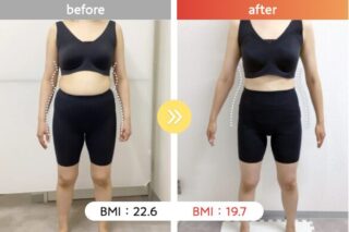 医療ダイエット