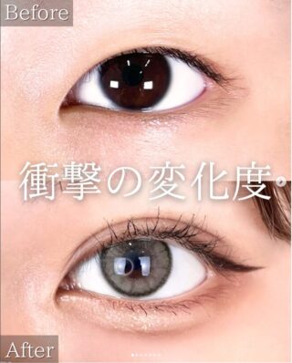 TCB式1dayクイックアイ
