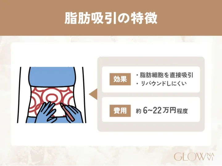 脂肪吸引の特徴